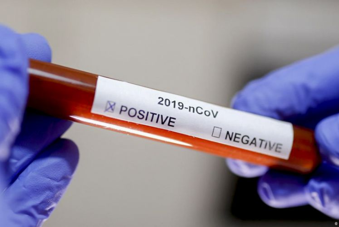 Klinikaların koronavirus testi müayinələrini - DAYANDIRDIQLARI BİLDİRİLİR | FED.az