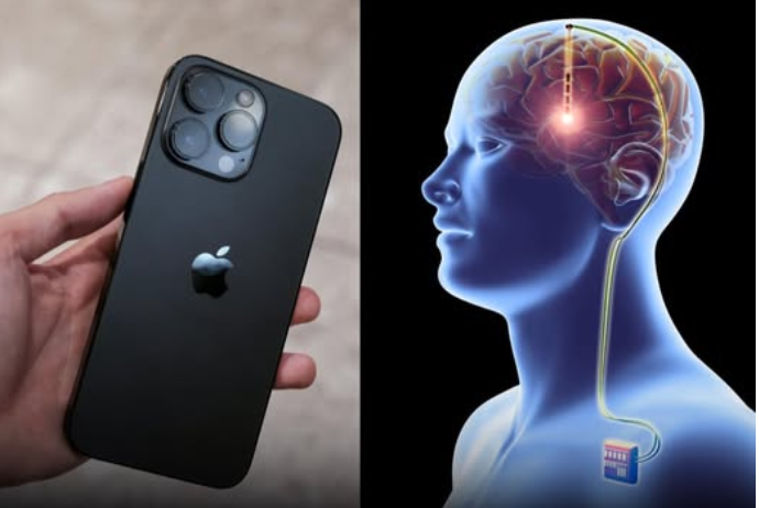 Beyin implantı ilə iPhone-u düşüncəylə idarə etmək mümkün olacaq | FED.az