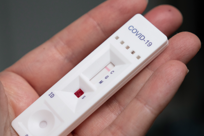 Rusiyada koronavirusun ştammlarının müəyyənləşdirilməsi üçün sürətli test sistemləri - Hazırlanıb | FED.az