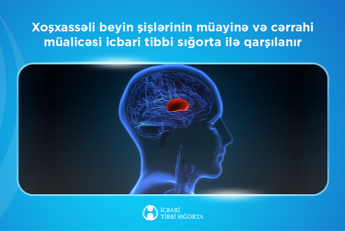 Ötən il sığorta ilə aparılan xoşxassəli beyin şişinin çıxarılması əməliyyatının sayı - AÇIQLANDI | FED.az