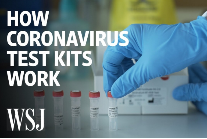 Çindən gətirilən koronavirus testləri - KEYFİYYƏTSİZ ÇIXDI | FED.az