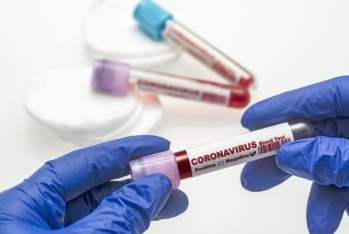 Nazirlik koronavirusa görə əməkdaşlarını test müayinəsindən keçirəcək