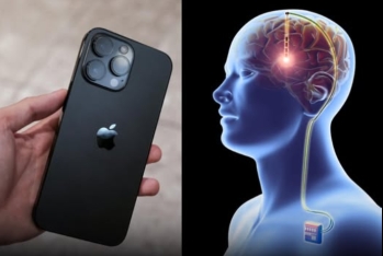 Beyin implantı ilə iPhone-u düşüncəylə idarə etmək mümkün olacaq