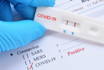 MİDA 58 minlik koronavirus testləri və maskalar aldı