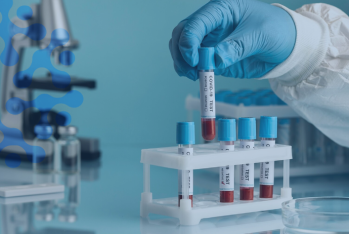 18 milyona yox dedilər, 10 milyona hə - LABORATORİYA TESTLƏRİ ALINDI