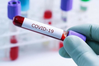 Koronavirusa yoluxanların sayı bu gün də 500-ü keçdi - 2 NƏFƏR VƏFAT ETDİ