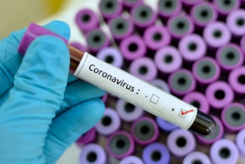 Azərbaycanda daha 1 nəfər koronavirusdan öldü - 67 YENİ YOLUXMA