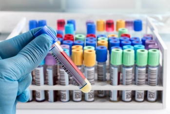 Tibbi qurum 41 milyon manatlıq laboratoriya testlərini - BU ŞİRKƏTDƏN ALDI