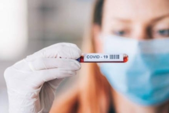 Ölkədə yayılan virus COVID imiş...