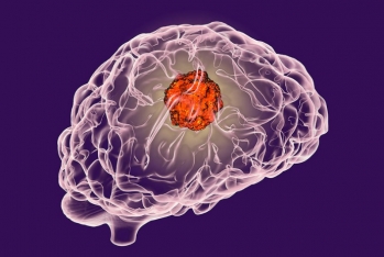 Ученые нашли лекарство от рака мозга