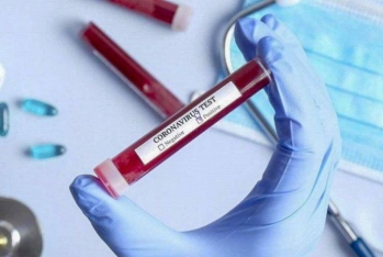 Almaniya şirkəti Azərbaycana koronavirus testi - SATMAQ İSTƏYİR - BİZNES TƏKLİF