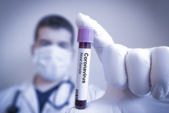 Koronavirusun müalicəsi üçün dərman - TƏQDİM EDİLDİ