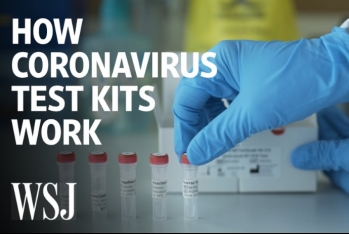 Çindən gətirilən koronavirus testləri - KEYFİYYƏTSİZ ÇIXDI