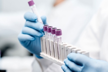 Dövlət qurumu 9 milyon manata yaxın tibbi sərf malları alır